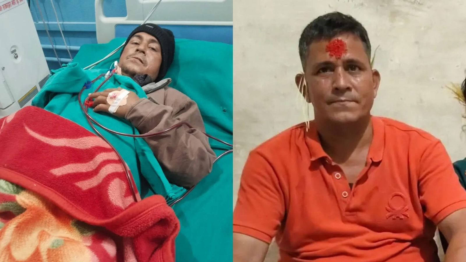 दुबै मृगौला फेल भएपछि लालु बुढाको उपचारमा समस्या, सहयोगका लागि अपिल